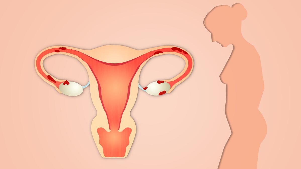 什么是肛周指检,什么是肛指检查