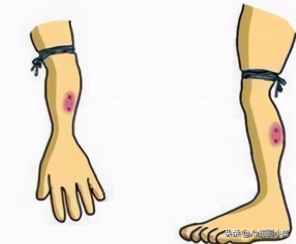 大连蛇岛旅游体验,大连蛇岛景区