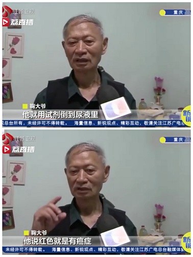 普通体检癌症能查到吗,常见的癌症筛查体检项目有哪些