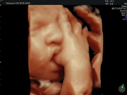 胎宝宝大小和手的比较,胎宝宝发育过程头的位置变化