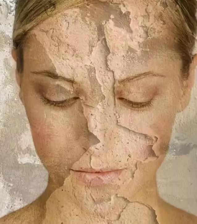 擦护肤品后皮肤刺痛是什么原因？