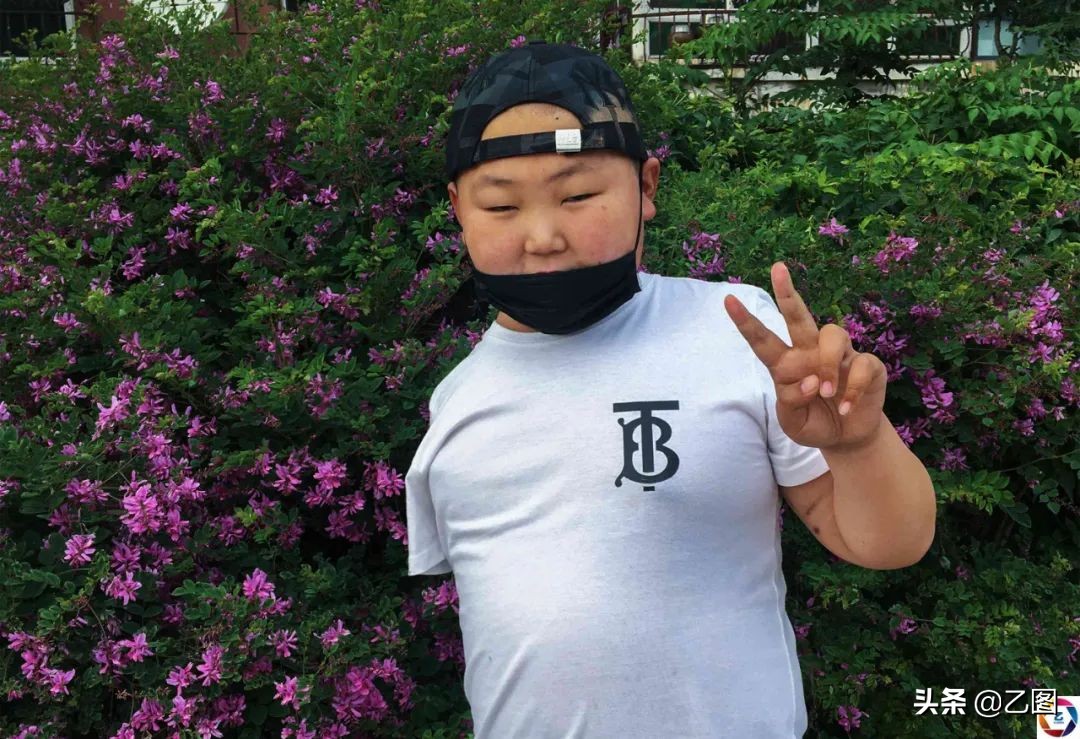 男孩手臂意外被断,男孩意外断臂急需救治