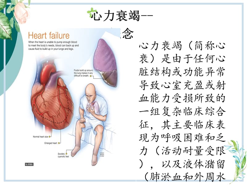 治疗心力衰竭最常用的药物名称,心力衰竭常用药物的适应症和禁忌