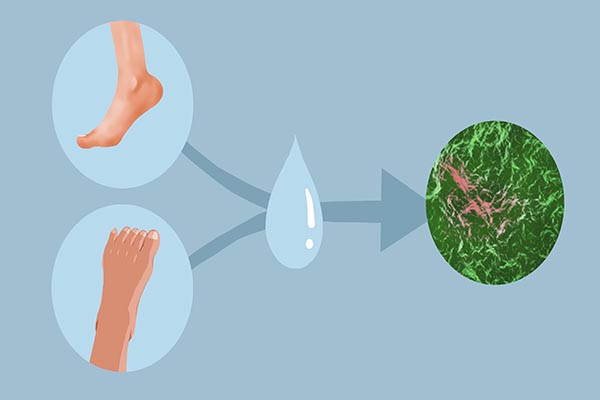 经常泡脚脚痒是怎么回事,经常泡脚对脚癣有好处吗