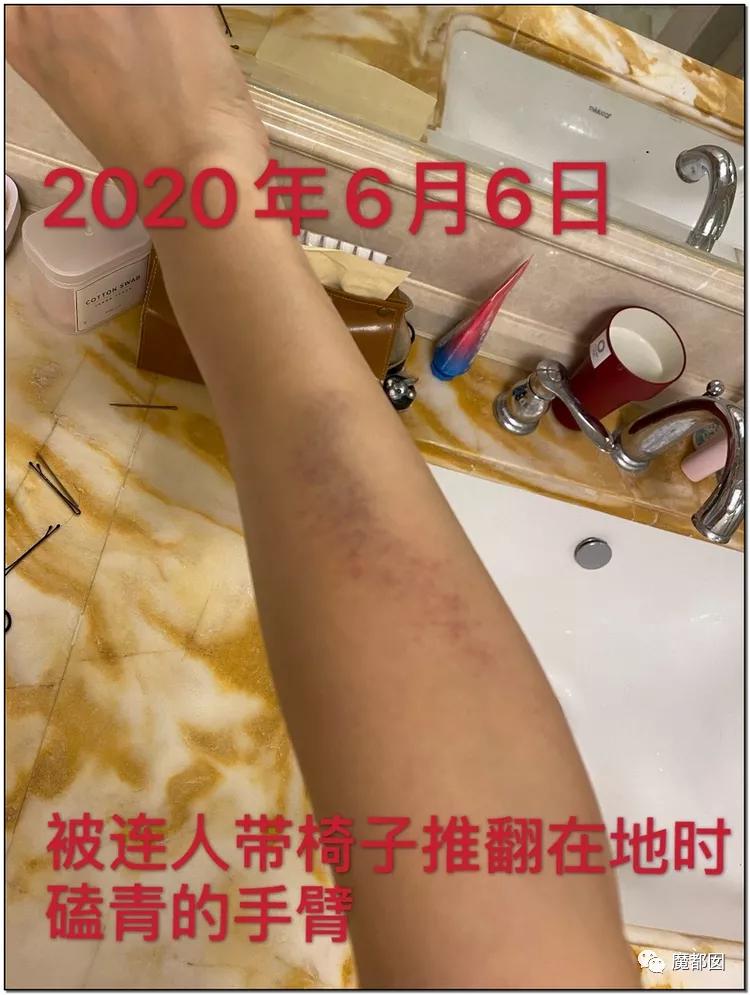 短跑名将张培萌被曝家暴反转,短跑名将张培萌家暴背后