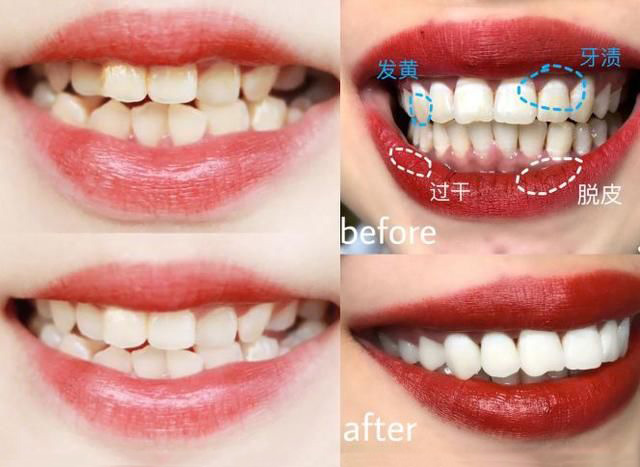 日本“黑科技”美牙产品：每天只需20秒，再也不用三天两头跑医院