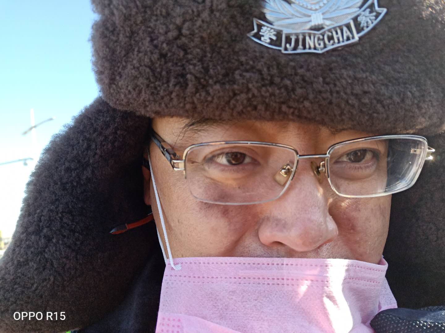 发黑硬痂还没脱落，又覆上一层冻红的新伤记住咱城市守门人的面孔