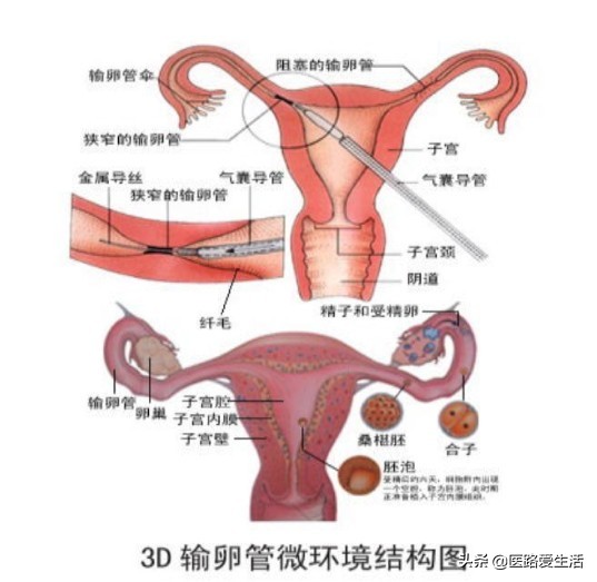 女人不孕迟早离婚,女人不孕大多会离婚吗