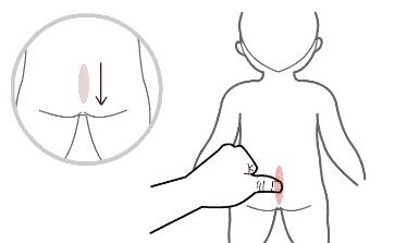 小儿推拿腹泻大便带粘液和血丝,宝宝腹泻拉血丝便小儿推拿有用吗