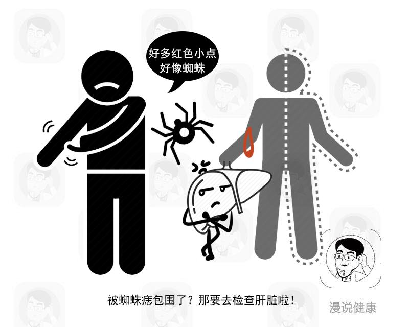 肝病患者出现的问题,肝病皮肤问题表现