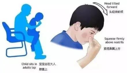 流鼻血了不仰头越流越凶？耳屎不掏影响听力？