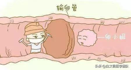 治疗输卵管近端不孕,输卵管性不孕的最佳治疗方法