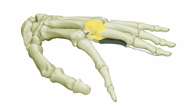 手部肌腱不完全断裂能完全复原吗,手部屈指肌腱损伤最难处理的部位