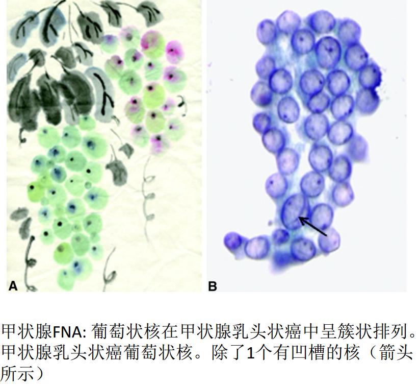 显微镜下的万花世界——走进病理学