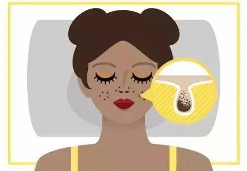 洗脸清洗黑头,洗脸清洁去粉刺