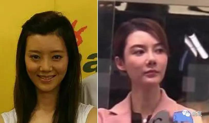 整容自毁前程的女明星,整容失去灵魂的女明星