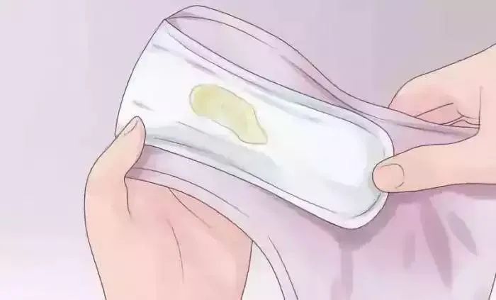 白带多跟怀孕有关吗,白带多是不是有问题