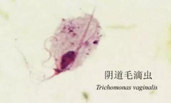 遭遇难“炎”之隐,很多女性居然选择这样做……