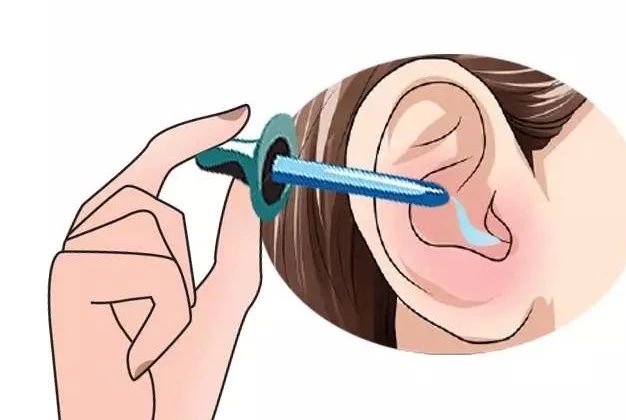 耳朵游泳进水嗡嗡响出不来,耳朵进水后像堵了一层膜听不清