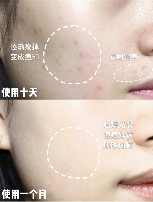 清水洗脸反而比洗面奶更好,清水洗脸和补水区别