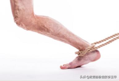 下肢静脉曲张外观不好看怎么办,下肢静脉曲张很难看怎么办