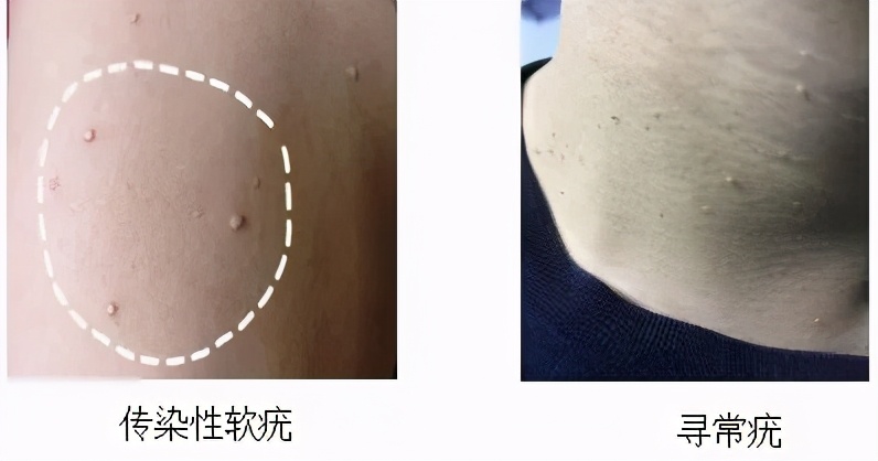 可以用搓澡巾搓全身吗,可以用搓澡巾搓脸上的泥吗