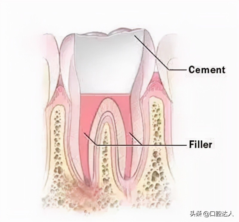 牙齿松动发炎肿痛吃什么消炎药,牙齿发炎松动吃什么消炎药