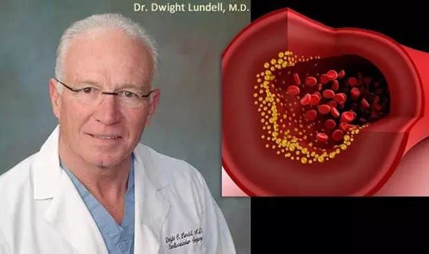 心脏病的真实原因，心脏病和炎症的关系……