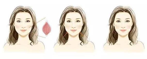 瘦脸针拯救脸部不适告别大饼脸,打完瘦脸针感觉脸部僵硬