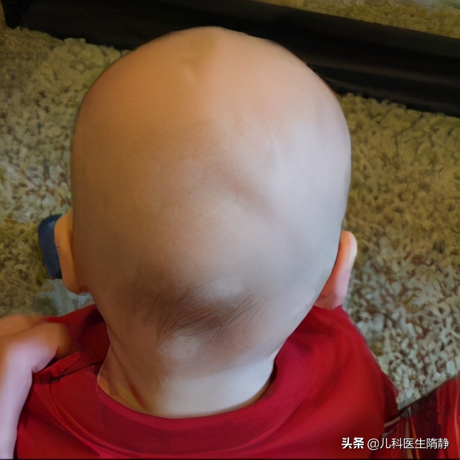 新生儿一些面部正常现象,新生儿出现这五种症状