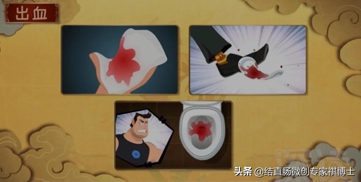 什么是混合痔疮的症状,女性痔疮和脱肛的症状