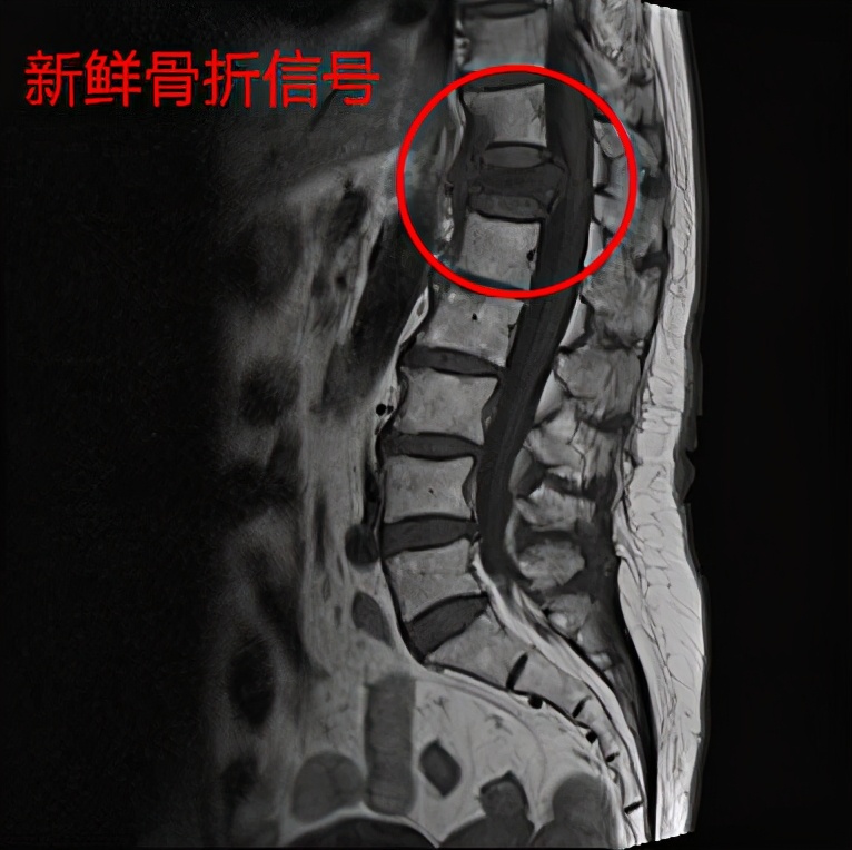 翻身痛坐起来也痛是怎么回事呀,呼吸翻身疼痛是什么原因