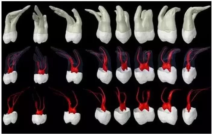 口腔保险根管治疗发生断针后,安抚患者的沟通技巧