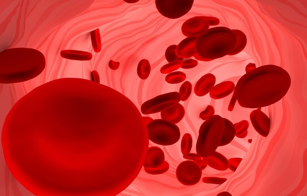 关于贫血诊断,贫血知识普及