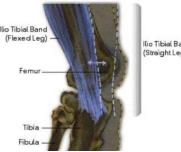 髂胫束摩擦综合征（膝外侧疼痛）跑步杀手，自我预防、康复的方法