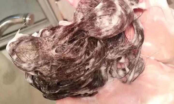 头屑满天飞用的洗发水,头屑一坨一坨的