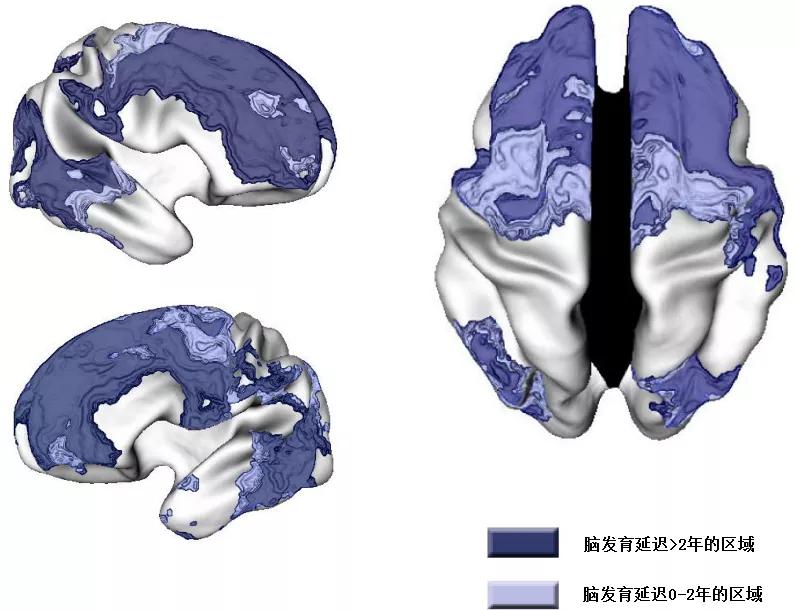 儿童注意缺陷与多动障碍怎么训练,宝宝多动障碍如何造成的