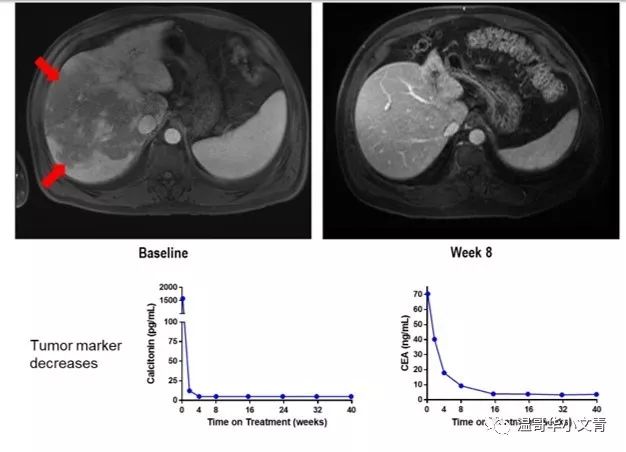 可以让人兴奋的药品,最新治疗甲状腺癌新药