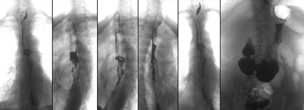 癌症早期发现的十大信号,如何发现早期癌症