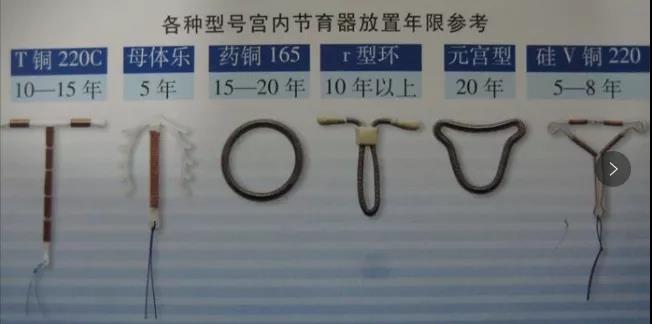 钉在子宫壁上的节育环,遗留在妈妈体内的节育环