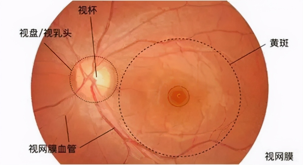 眼底刚查正常但突然有飞蚊症,眼病早知道的症状