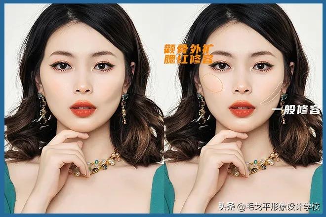 太阳穴凹陷颧骨突出怎么整容,颧骨外扩太阳穴凹陷整容