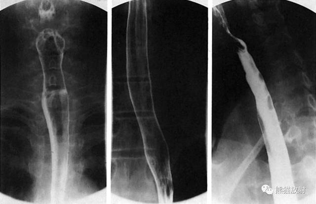 详细的消化道造影+彩色解剖图