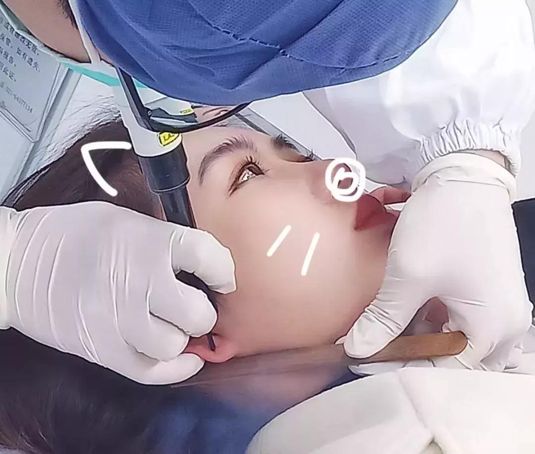 想打耳洞又怕打了不好看,想打耳洞但是怕耳洞长脏东西