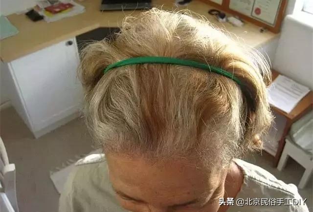 光腿神器丝袜破洞了怎么补救,网眼袜破洞怎么补