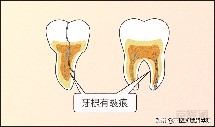 一招解决磨牙的危害,磨牙很严重最好的磨牙解决方法