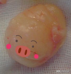 皮肤起小肉球怎么回事,大腿皮肤下面有个小肉球