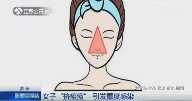 护肤美白祛痘抗皱,祛痘有效成分有哪些护肤品