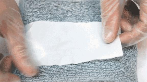 口周长脓痘什么原因,口周长脓性痘是什么原因