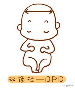 双顶径头围腹围对照表胎儿体重,如何判断胎儿股骨长短